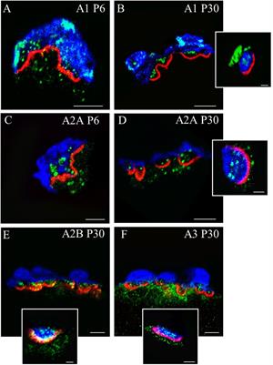 Adenosine Receptors in Developing and Adult Mouse Neuromuscular Junctions and Functional Links With Other Metabotropic Receptor Pathways